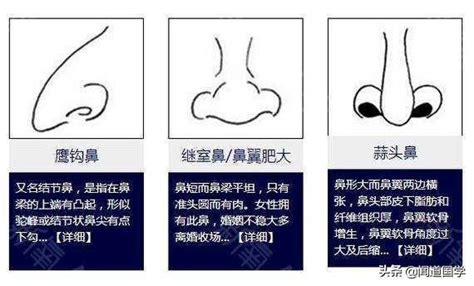 鼻子歪面相|面相入门